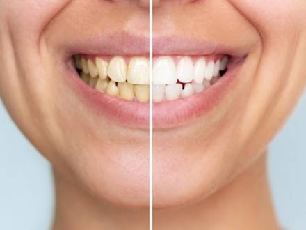 Annandale, VA cosmetic dentist