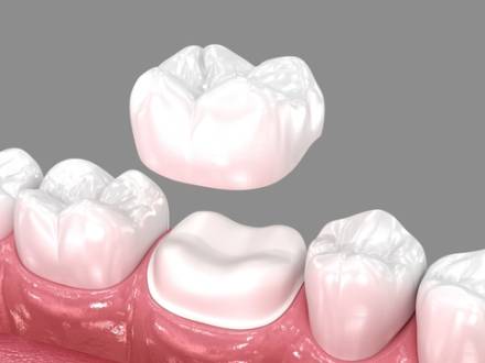 Alexandria, VA Cosmetic Dentist
